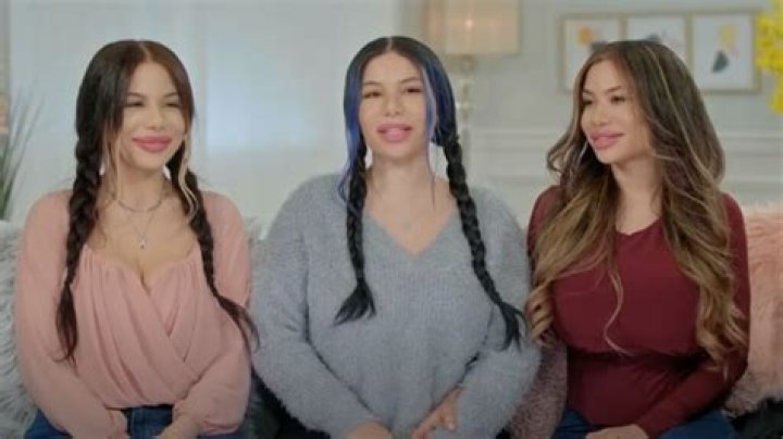 Capasso Triplets’ Plastic Surgery: The Extreme Sisters Gets Matching Cosmetic Procedures to Look the Same!