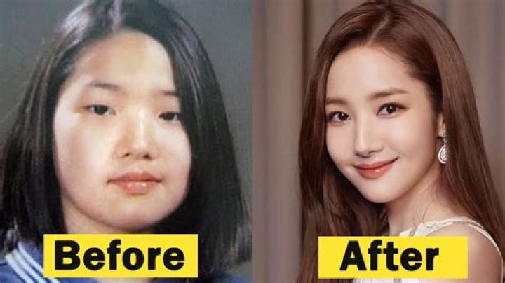 Did Yeonmi Park Undergo Plastic Surgery? Everything From Her Lies to Husband And Son
