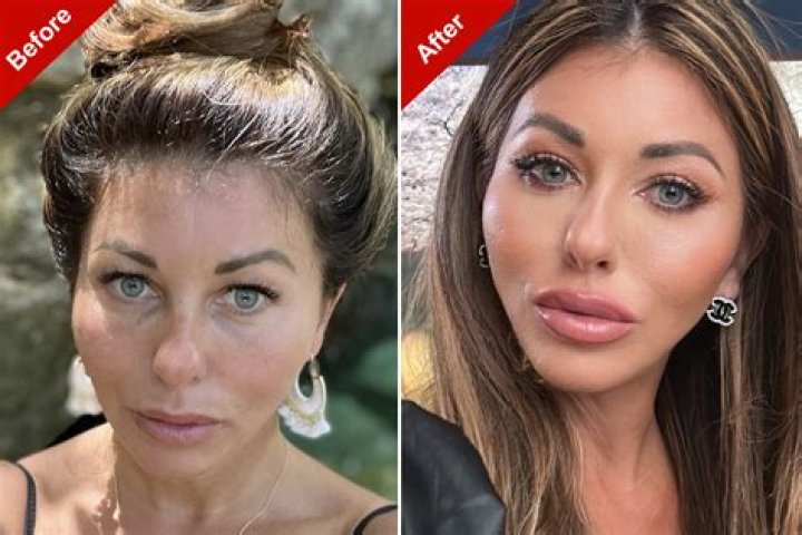 Fact Check: Did Veronika Rajec Go Through Plastic Surgery Or Is It Just A Rumor? Everything About The Model