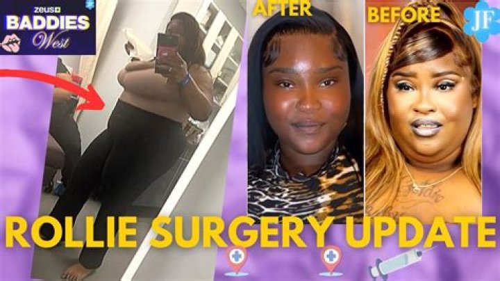 Rollie BBL Before And After Photo: Surgery Update 2023